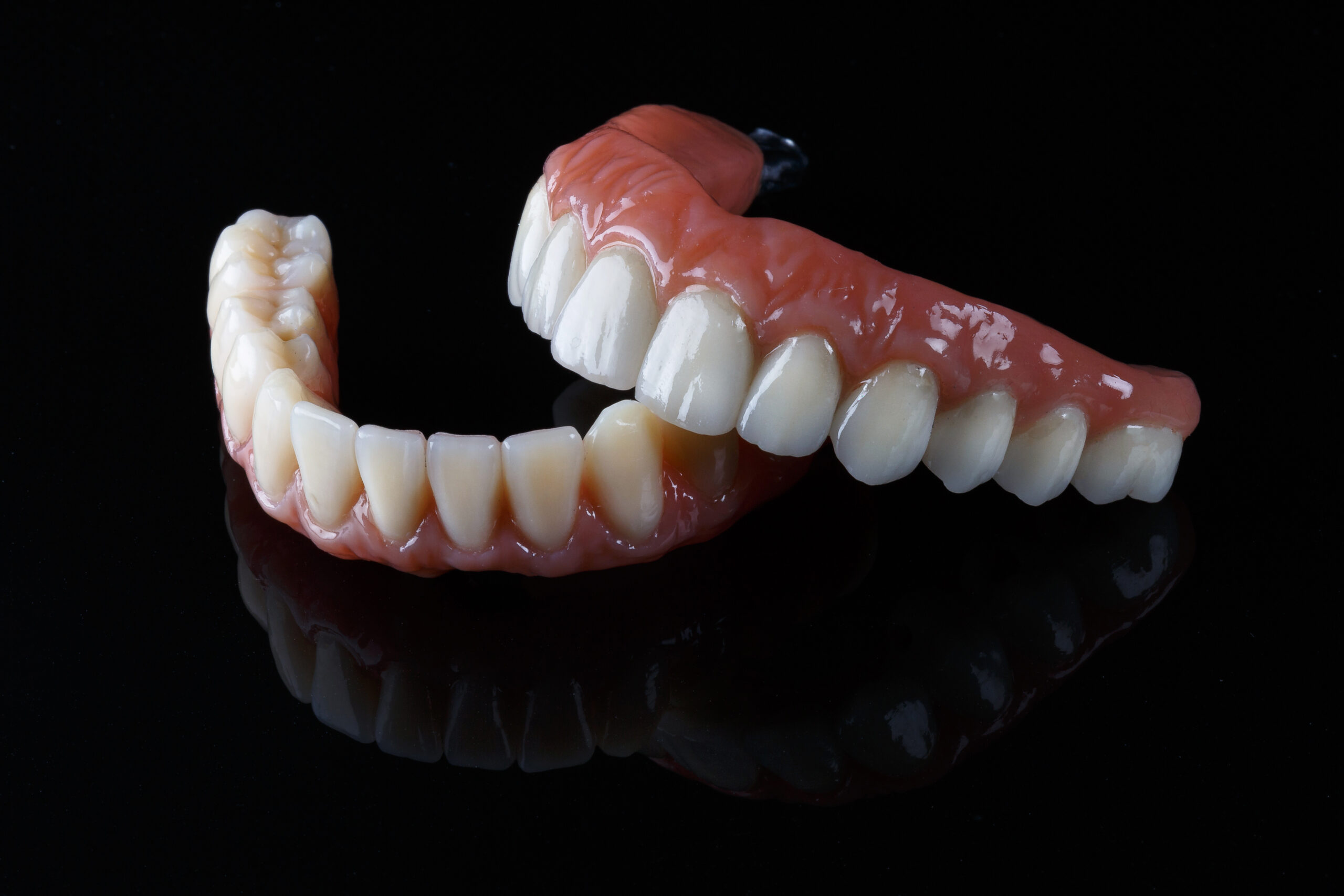 full mouth dental implant prothesis models.
