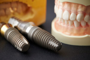 Photo of implant and tooth model.